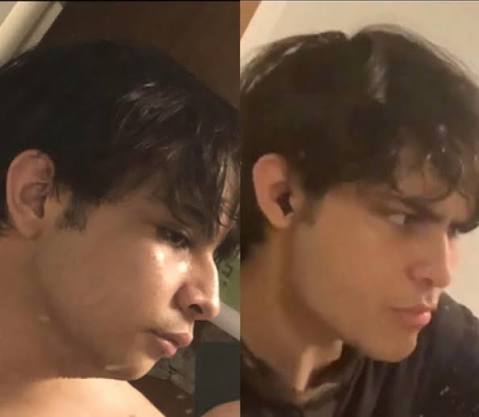 Falim Gum before and after